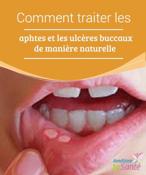 huile essentielle et huile essentielle ulcere buccal