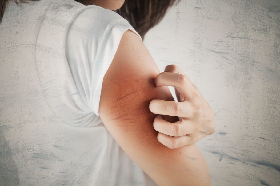 Dermatillomanie: définition, causes psychologiques, solutions– Comment guérir