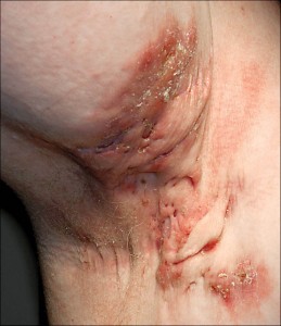 Top 10 des conditions médicales les plus dégoûtantes– Comment guérir