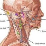 Glandes enflées dans le cou - symptômes, causes, traitement

 - Comment guérir