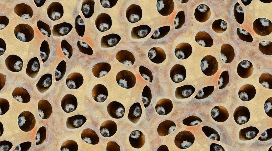 Voir Dr.Pimple Popper Pop Serious Blackheads dans une vidéo YouTube– Comment guérir